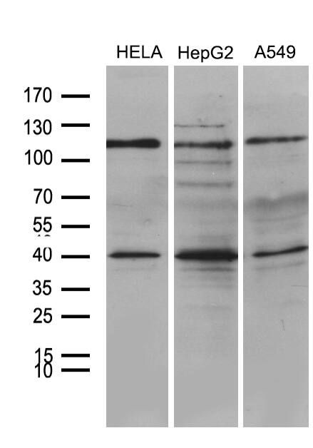 PHF20L1 Antibody (OTI1B4) Western Blot;PHF20L1 Antibody (OTI1B4)[NBP3-44703]-