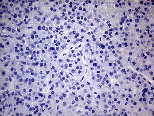 PMP22 Antibody (OTI5D1) Immunohistochemistry;PMP22 Antibody (OTI5D1)[NBP3-44709]-