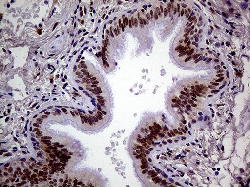 MAGEB4 Antibody (OTI3H2) Immunohistochemistry;MAGEB4 Antibody (OTI3H2)[NBP3-44712]-