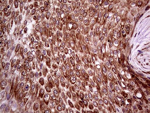 ERLIN1 Antibody (OTI4B1) Immunohistochemistry;ERLIN1 Antibody (OTI4B1)[NBP3-44713]-