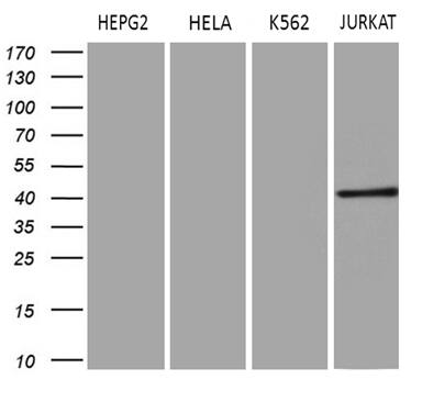 ERLIN1 Antibody (OTI4C11) Western Blot;ERLIN1 Antibody (OTI4C11)[NBP3-44714]-