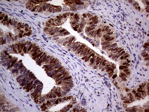 MAGEB4 Antibody (OTI1B5) Immunohistochemistry;MAGEB4 Antibody (OTI1B5)[NBP3-44723]-