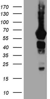 GRB7 Antibody (OTI6H2) Western Blot;GRB7 Antibody (OTI6H2)[NBP3-44728]-