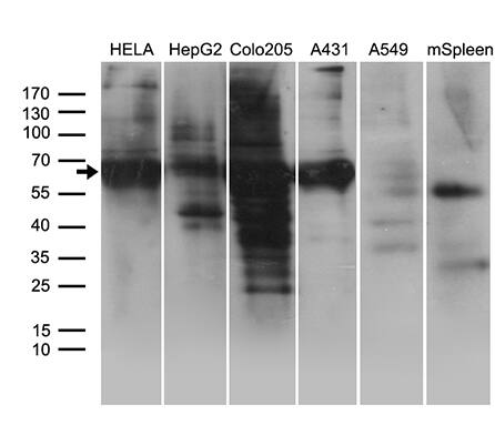 GRB7 Antibody (OTI15E7) Western Blot;GRB7 Antibody (OTI15E7)[NBP3-44729]-