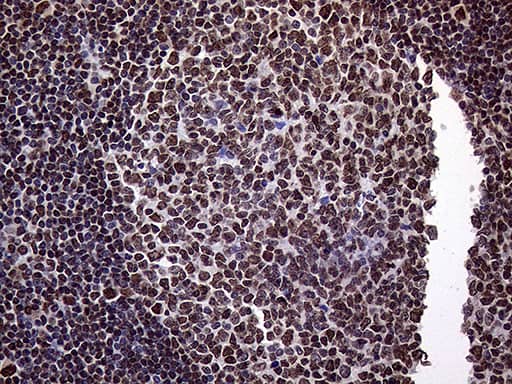 TRMT5 Antibody (OTI1B5) Immunohistochemistry;TRMT5 Antibody (OTI1B5)[NBP3-44733]-