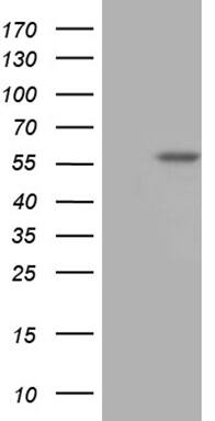 TBX20 Antibody (OTI2C7) Western Blot;TBX20 Antibody (OTI2C7)[NBP3-44736]-