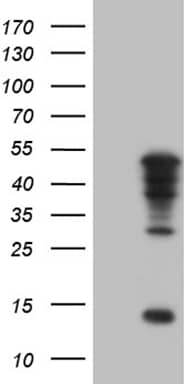 TBX20 Antibody (OTI6C9) Western Blot;TBX20 Antibody (OTI6C9)[NBP3-44739]-