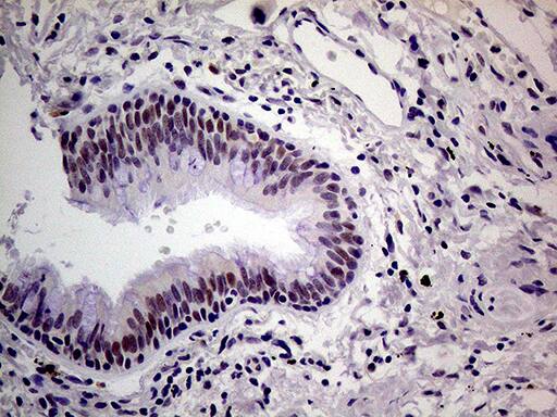 THOC3 Antibody (OTI4H6) Immunohistochemistry;THOC3 Antibody (OTI4H6)[NBP3-44742]-