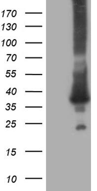 RAB23 Antibody (OTI2F3) Western Blot;RAB23 Antibody (OTI2F3)[NBP3-44744]-