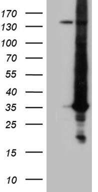 RAB23 Antibody (OTI2A8) Western Blot;RAB23 Antibody (OTI2A8)[NBP3-44745]-
