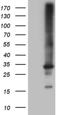 RAB23 Antibody (OTI4C7) Western Blot;RAB23 Antibody (OTI4C7)[NBP3-44748]-