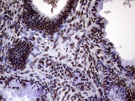 XRN2 Antibody (OTI5F4) Immunohistochemistry;XRN2 Antibody (OTI5F4)[NBP3-44752]-