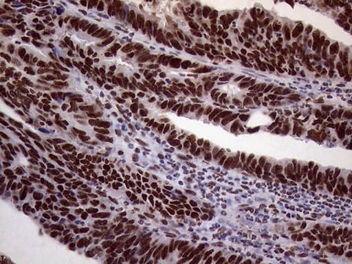 XRN2 Antibody (OTI5F4) Immunohistochemistry;XRN2 Antibody (OTI5F4)[NBP3-44752]-