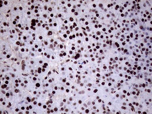 XRN2 Antibody (OTI5F4) Immunohistochemistry;XRN2 Antibody (OTI5F4)[NBP3-44752]-