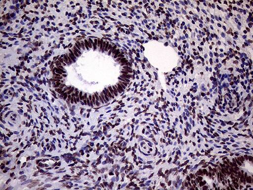 XRN2 Antibody (OTI5F4) Immunohistochemistry;XRN2 Antibody (OTI5F4)[NBP3-44752]-