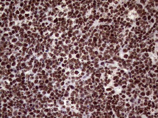 XRN2 Antibody (OTI5F4) Immunohistochemistry;XRN2 Antibody (OTI5F4)[NBP3-44752]-