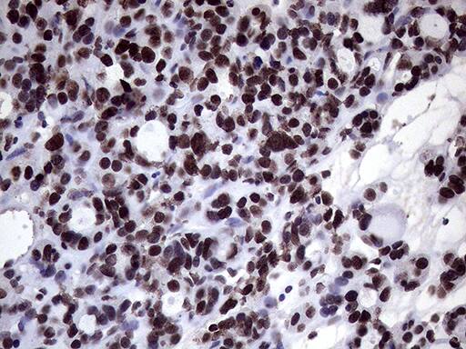 XRN2 Antibody (OTI5F4) Immunohistochemistry;XRN2 Antibody (OTI5F4)[NBP3-44752]-