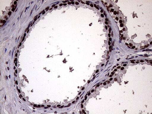 XRN2 Antibody (OTI5F4) Immunohistochemistry;XRN2 Antibody (OTI5F4)[NBP3-44752]-