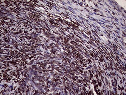 XRN2 Antibody (OTI5F4) Immunohistochemistry;XRN2 Antibody (OTI5F4)[NBP3-44752]-
