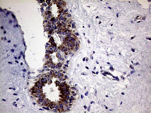 CLIP4 Antibody (OTI5D10) Immunohistochemistry;CLIP4 Antibody (OTI5D10)[NBP3-44756]-