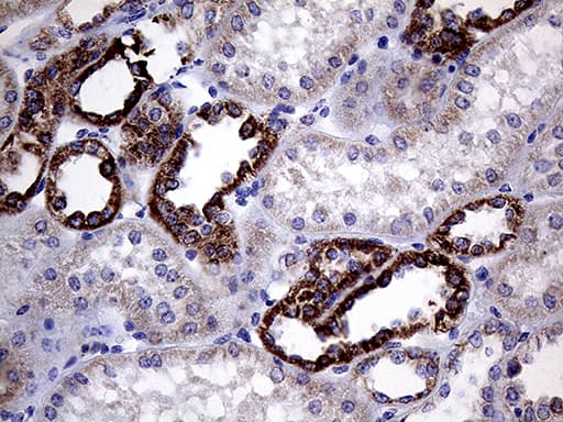 CLIP4 Antibody (OTI5D10) Immunohistochemistry;CLIP4 Antibody (OTI5D10)[NBP3-44756]-