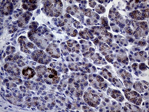 CLIP4 Antibody (OTI5D10) Immunohistochemistry;CLIP4 Antibody (OTI5D10)[NBP3-44756]-