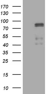 CLIP4 Antibody (OTI5D10) Western Blot;CLIP4 Antibody (OTI5D10)[NBP3-44756]-