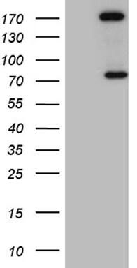 RhoGAP Antibody (OTI9H2) Western Blot;RhoGAP Antibody (OTI9H2)[NBP3-44757]-