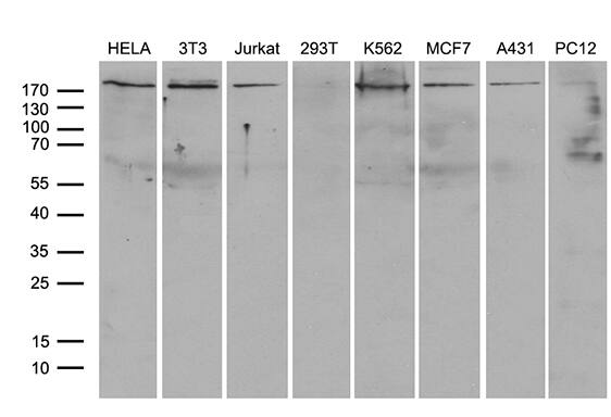 RhoGAP Antibody (OTI9H2) Western Blot;RhoGAP Antibody (OTI9H2)[NBP3-44757]-