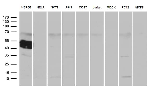 ZCCHC17 Antibody (OTI1F11) Western Blot;ZCCHC17 Antibody (OTI1F11)[NBP3-44765]-