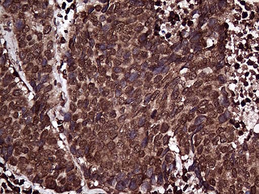 RPL10A Antibody (OTI2G9) Immunohistochemistry;RPL10A Antibody (OTI2G9)[NBP3-44766]-