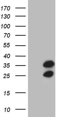 RPL10A Antibody (OTI2G9) Western Blot;RPL10A Antibody (OTI2G9)[NBP3-44766]-