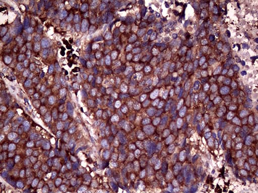 RPL10A Antibody (OTI4B2) Immunohistochemistry;RPL10A Antibody (OTI4B2)[NBP3-44768]-