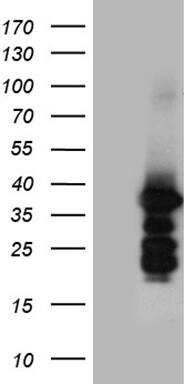 ZCCHC17 Antibody (OTI7F9) Western Blot;ZCCHC17 Antibody (OTI7F9)[NBP3-44774]-