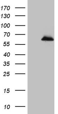 ZNF329 Antibody (OTI5E5) Western Blot;ZNF329 Antibody (OTI5E5)[NBP3-44778]-