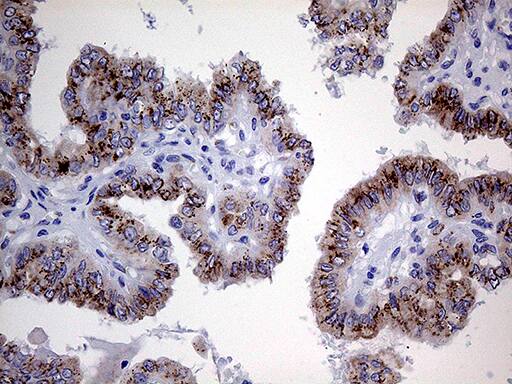 Myotilin Antibody (OTI5E11) Immunohistochemistry;Myotilin Antibody (OTI5E11)[NBP3-44783]-