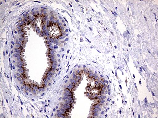 Myotilin Antibody (OTI5E11) Immunohistochemistry;Myotilin Antibody (OTI5E11)[NBP3-44783]-