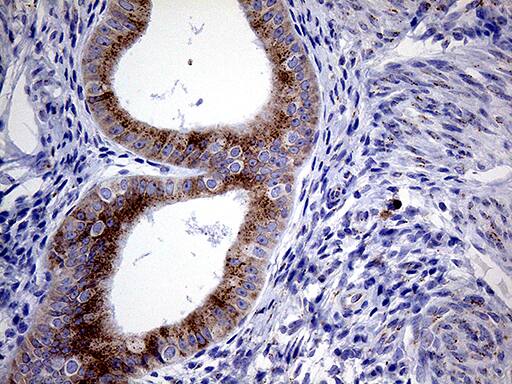 Myotilin Antibody (OTI5E11) Immunohistochemistry;Myotilin Antibody (OTI5E11)[NBP3-44783]-