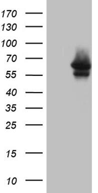 Myotilin Antibody (OTI5E11) Western Blot;Myotilin Antibody (OTI5E11)[NBP3-44783]-