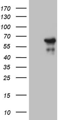 ZNF329 Antibody (OTI7F2) Western Blot;ZNF329 Antibody (OTI7F2)[NBP3-44789]-