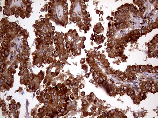 RRBP1 Antibody (OTI3F1) Immunohistochemistry;RRBP1 Antibody (OTI3F1)[NBP3-44798]-