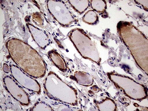 RRBP1 Antibody (OTI3F1) Immunohistochemistry;RRBP1 Antibody (OTI3F1)[NBP3-44798]-