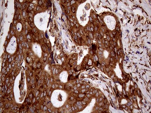 RRBP1 Antibody (OTI3F1) Immunohistochemistry;RRBP1 Antibody (OTI3F1)[NBP3-44798]-