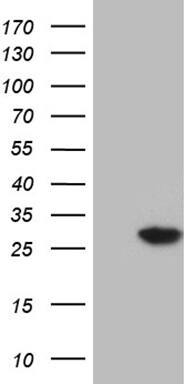 NUDT4 Antibody (OTI1C2) Western Blot;NUDT4 Antibody (OTI1C2)[NBP3-44808]-