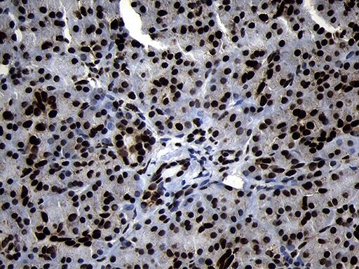 HOXC4 Antibody (OTI1F6) Immunohistochemistry;HOXC4 Antibody (OTI1F6)[NBP3-44809]-