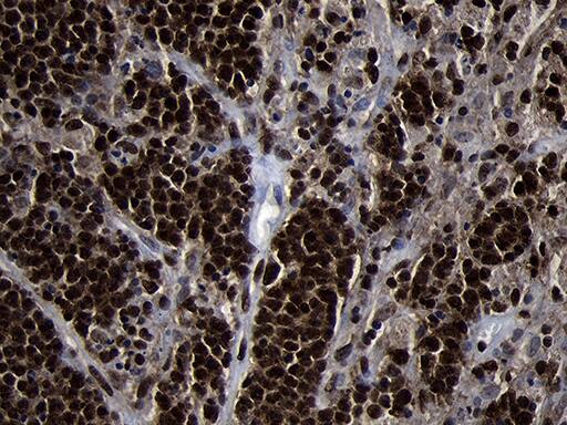 HOXC4 Antibody (OTI1F6) Immunohistochemistry;HOXC4 Antibody (OTI1F6)[NBP3-44809]-