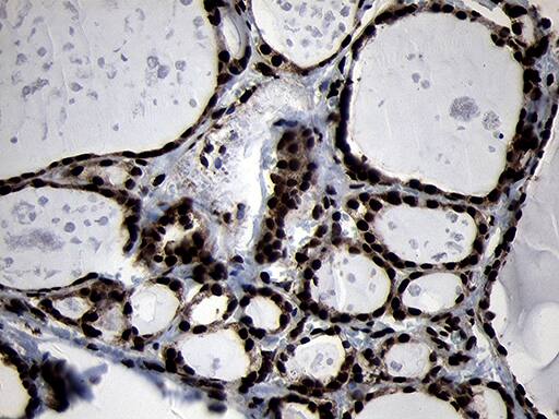 HOXC4 Antibody (OTI1F6) Immunohistochemistry;HOXC4 Antibody (OTI1F6)[NBP3-44809]-