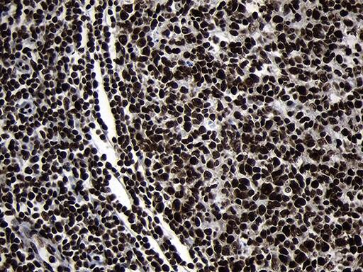 HOXC4 Antibody (OTI1F6) Immunohistochemistry;HOXC4 Antibody (OTI1F6)[NBP3-44809]-