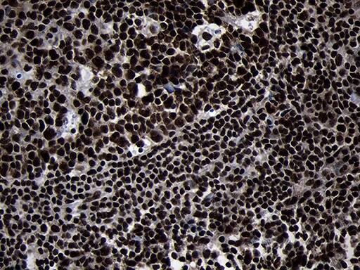 HOXC4 Antibody (OTI1F6) Immunohistochemistry;HOXC4 Antibody (OTI1F6)[NBP3-44809]-