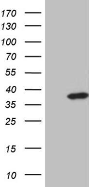 ZMAT4 Antibody (OTI9E11) Western Blot;ZMAT4 Antibody (OTI9E11)[NBP3-44810]-
